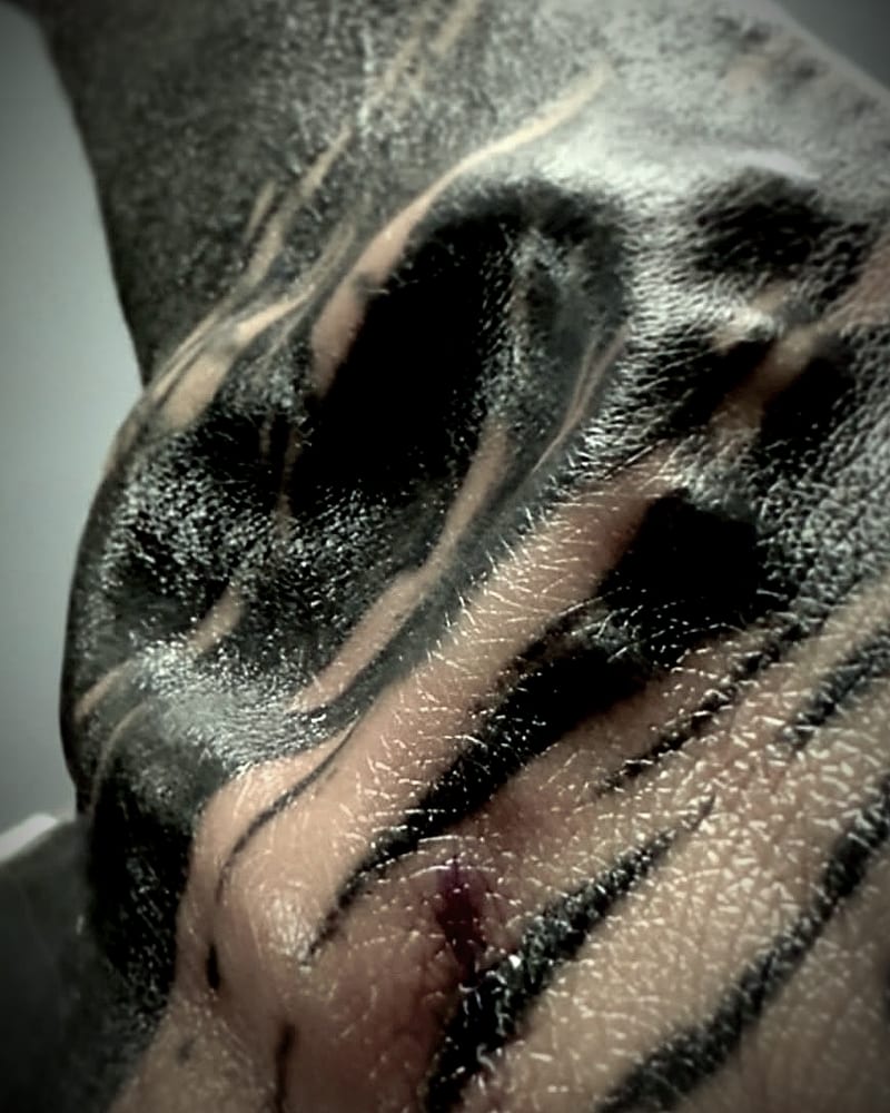 Implants under the black tattoo work on the back of my hand