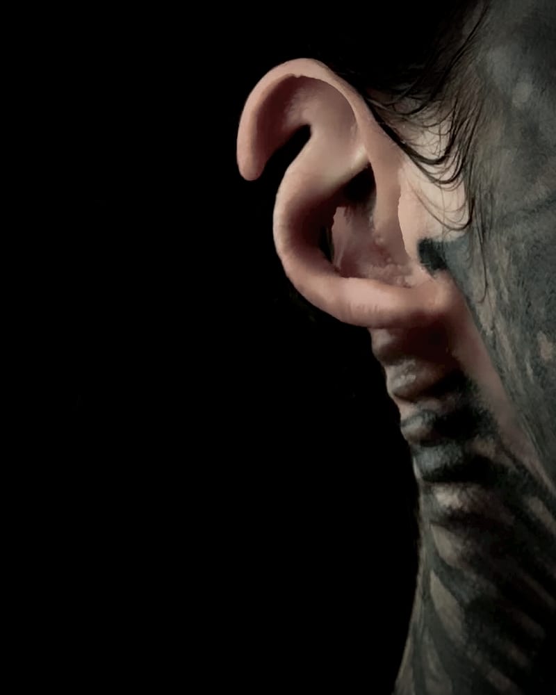 My pointed ear with the conch removed, healed